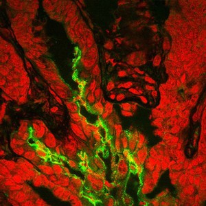 view Bacteria infecting the colon