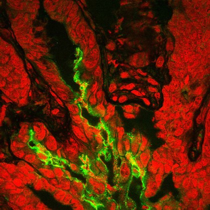 Bacteria infecting the colon