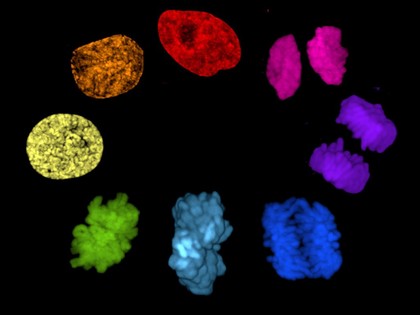 Human chromosomes during cell division