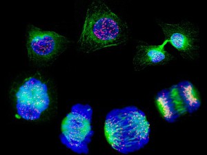 view Human cells showing the stages of cell division