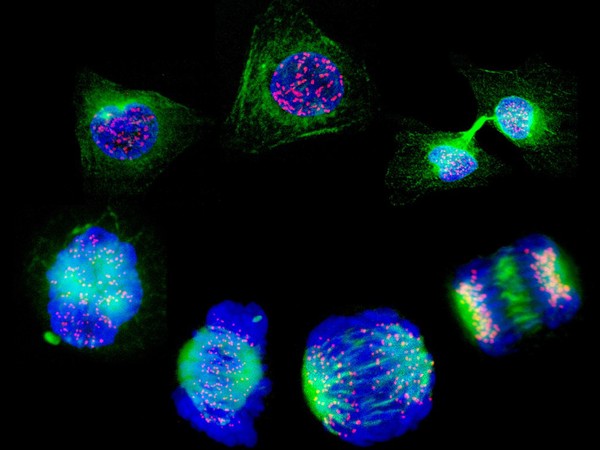 Human cells showing the stages of cell division