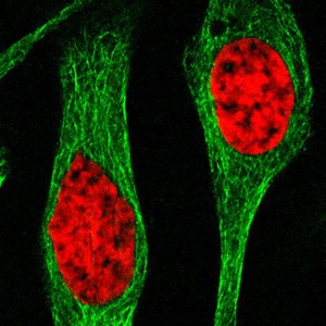 view Two human cells in interphase. The microtubules are stained in green and the DNA in red.