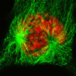 view Human cell in late prophase