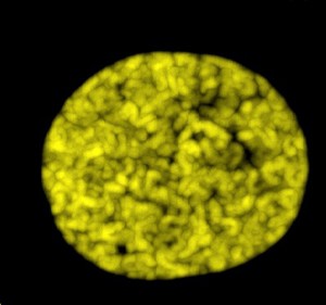 view Nucleus in late prophase