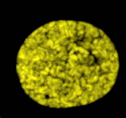 Nucleus in late prophase