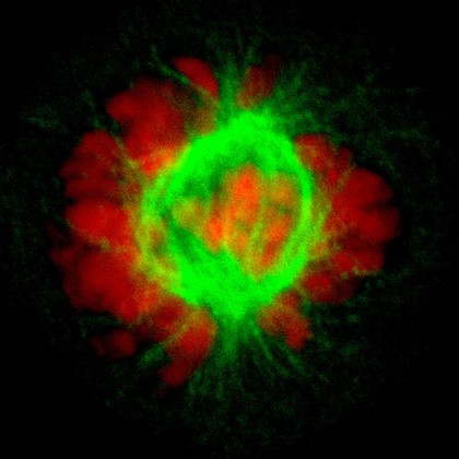 HeLa cell in prometaphase. The chromatin is stained red and the microtubules forming the spindle stained green. The chromatin has condensed but there is not yet complete attachment of the chromosomes to the spindle.