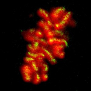 view Human chromosomes in metaphase. The chromatin is stained red and the "glue" that holds the two chromatids together is highlighted in yellow. This glue is a proteinaceous complex called cohesin. Once all the chromosomes are attached to the spindle, the cohesin complex breaks down, allowing the two chromatids to separate and move to opposite poles of the cell.