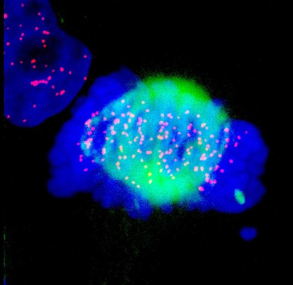 Human cell in metaphase