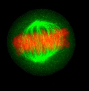 view Human cell in metaphase