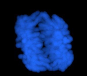 view Human chromosomes in early anaphase. At this stage the chromosomes have started to separate from each other and move towardds opposite poles of the cell.