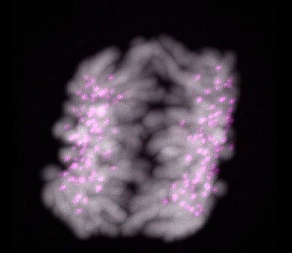 Human chromosomes in early anaphase. At this stage the chromosomes have started to separate from each other and move towards opposite poles of the cell. The chromatin appears grey and the kinetochores are pink.