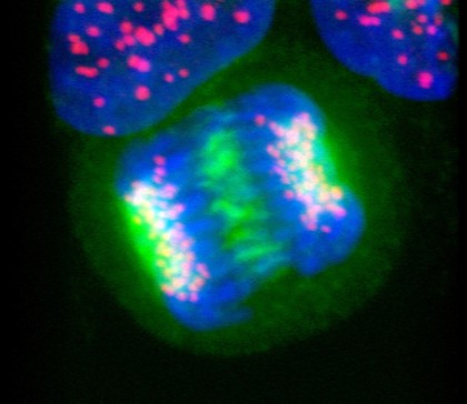 Human cell in anaphase