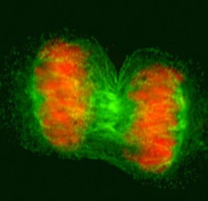 view Human cell in anaphase