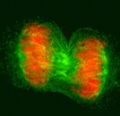 Human cell in anaphase