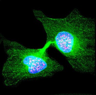 Human cell in telophase