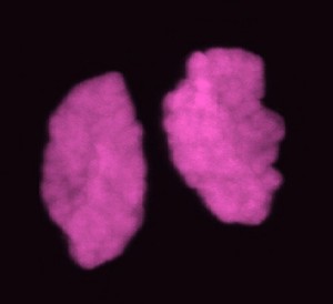 view Human chromosomes in telophase. The chromosomes have separated and decondensed, and the new nuclear envelope forms.