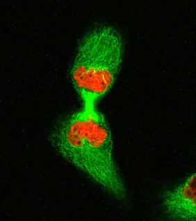 Human cell in telophase