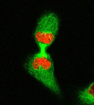 view Human cell in telophase