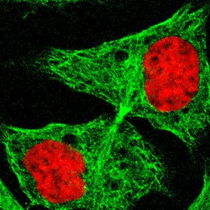 view Human cell early in cytokinesis