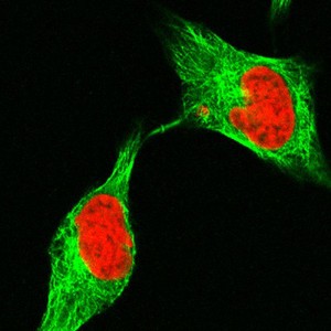 view Human cell late in cytokinesis