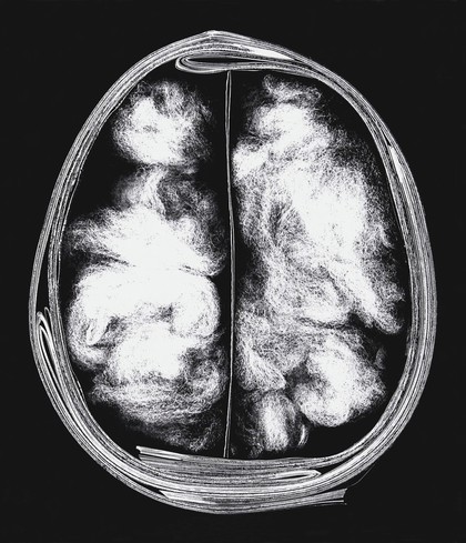 Understanding the workings of the brain