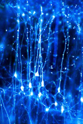 Neurons in the brain