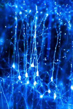 view Neurons in the brain