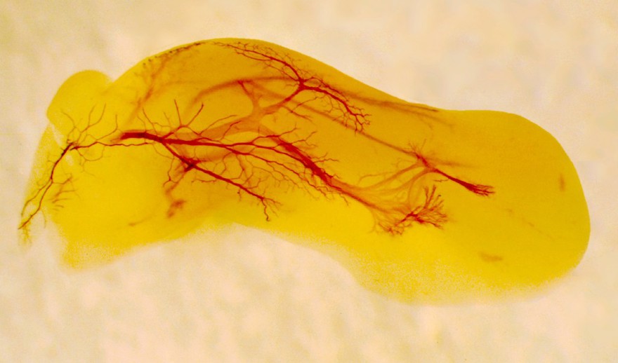 Embryonic nerves growing into the developing limb