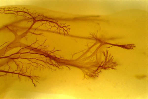 Embryonic nerves growing into the developing limb