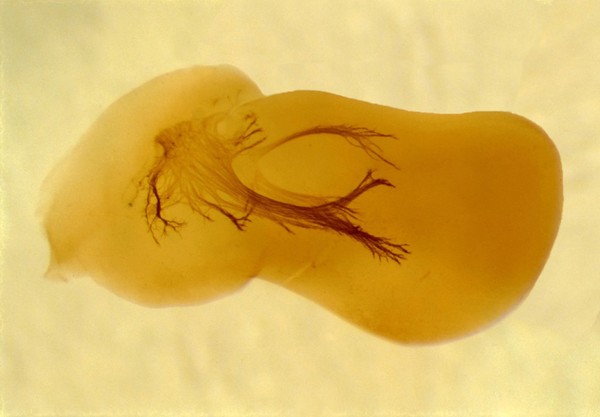 Embryonic nerves growing into the developing limb