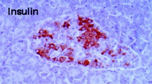 view Beta cells secreting insulin in human pancreas