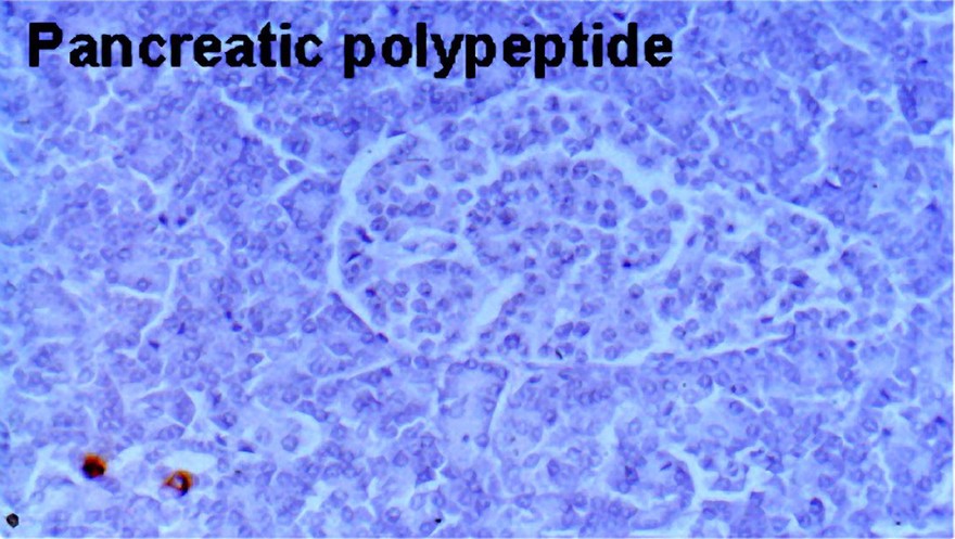Secretion of pancreatic polypeptide in human pancreas