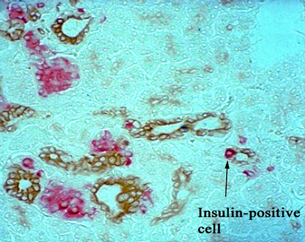 Development of islet cells from pancreatic ducts