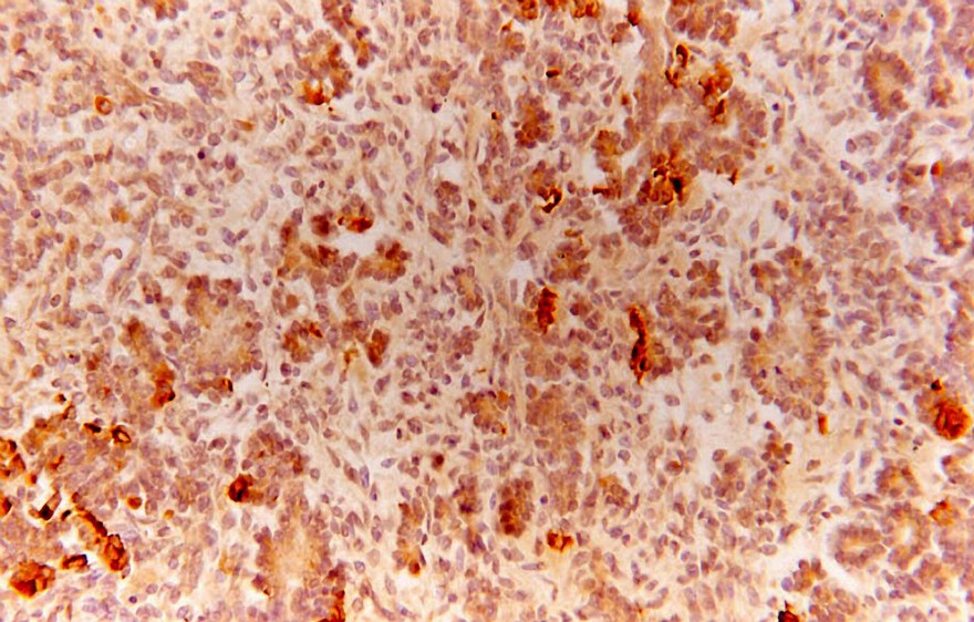 Formation of islets from ductal cells in foetal pancreas