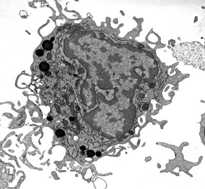 Normal gut cell