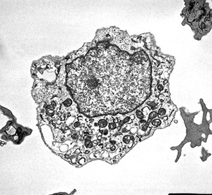 view TWM of gut cell undergoing necrosis
