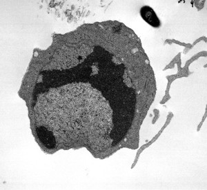 view TEM Gut cell undergoing apoptosis, with capped chromatin