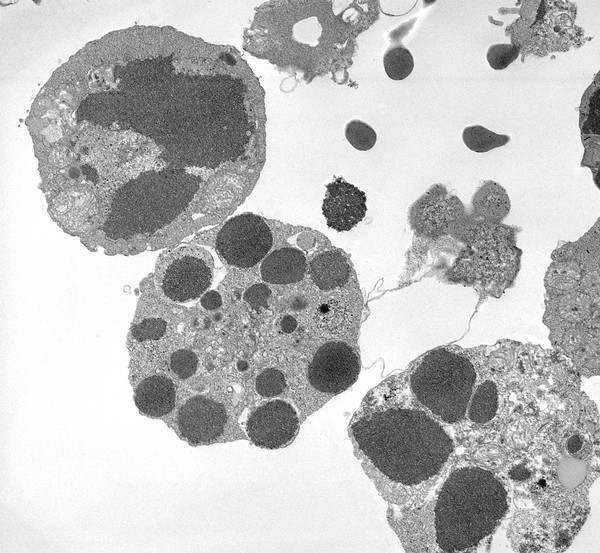 Gut cells undergoing apoptosis