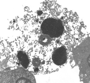 view TEM gut cell undergoing secondary necrosis