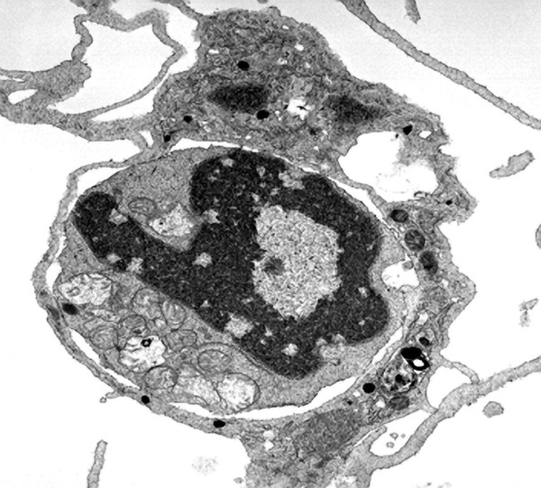 TEM cell being ingested by phagocytosis