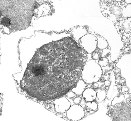 TEM cell in late stage of necrosis