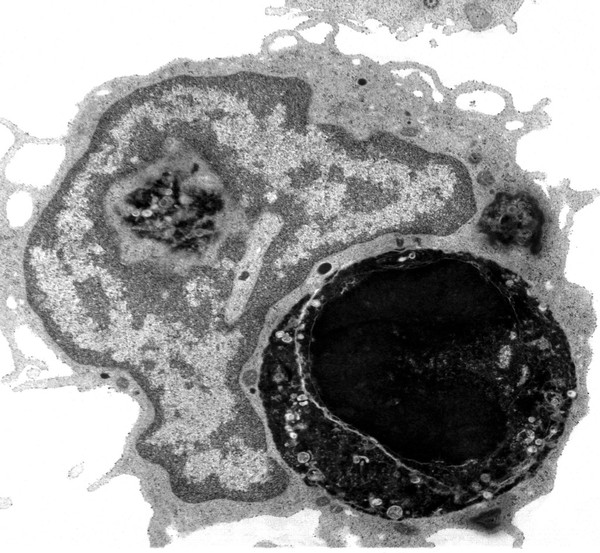 TEM of cell performing phagocytosis