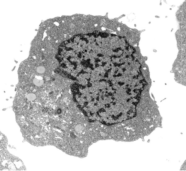 TEM normal cell