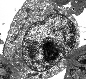 view TEM of cell undergoing necrosis