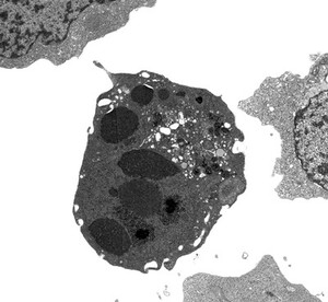 view TEM cell showing capped chromatin - apoptosis