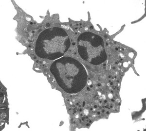 view TEM normal neutrophil