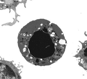 view TEM Jurkat T cell showing typical clumped heterochromatin.