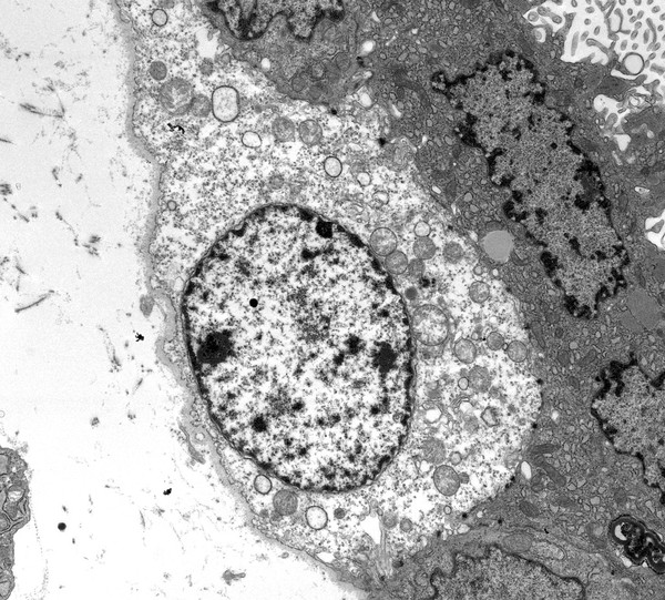 TEM cell