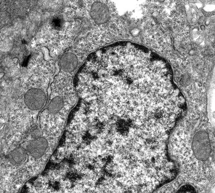 TEM normal cell, close-up