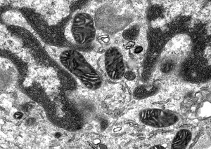 view TEM cell undergoing apoptosis, with mitochondrial pycnosis